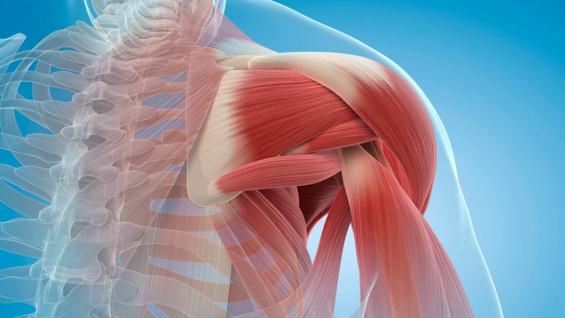 which term means the rupture of a muscle?